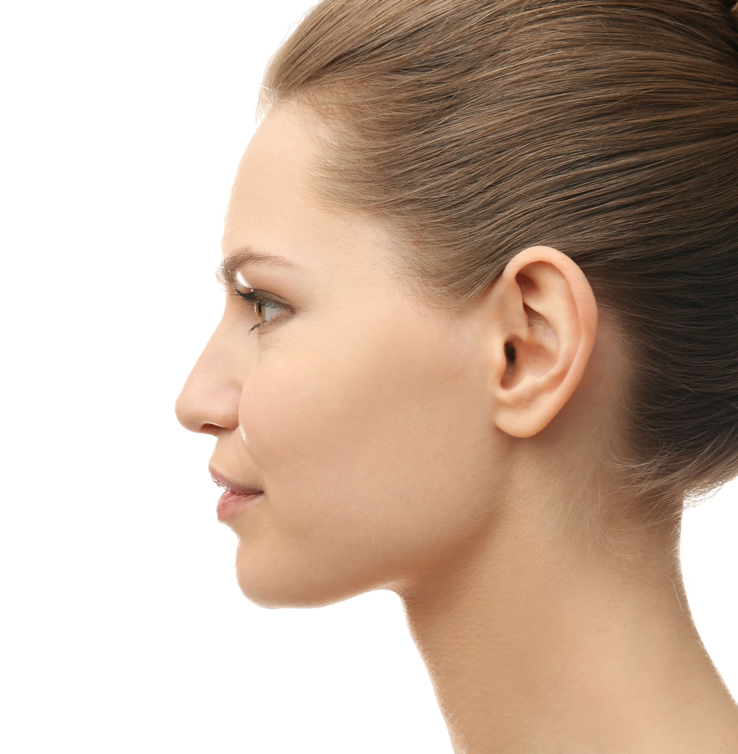 Otoplasty (ear reshaping)
