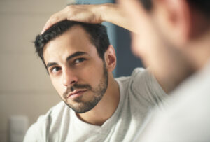 Man worried for hair loss and looking at mirror his receding hairline and thinking is male hairline lowering surgery a permanent procedure?