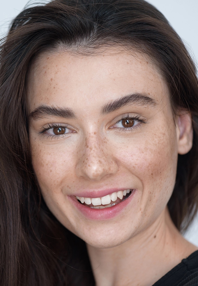 How long does chin implant surgery healing take?